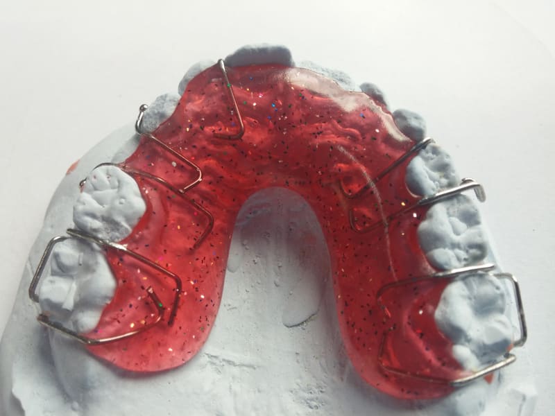 Patient smiling confidently after completing a cosmetic dental treatment